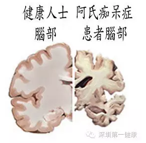 1483947838844584.png thm.png