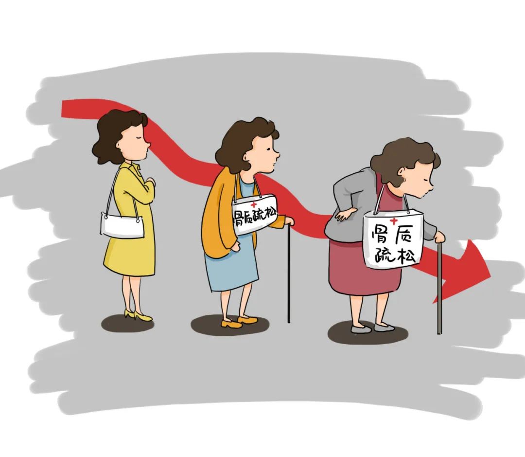 弄明白T值和Z值，轻松看懂骨密度检测报告