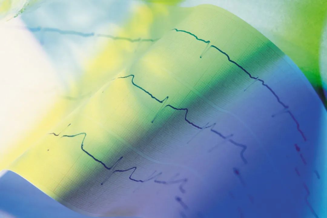 快速看懂心电图的体检报告